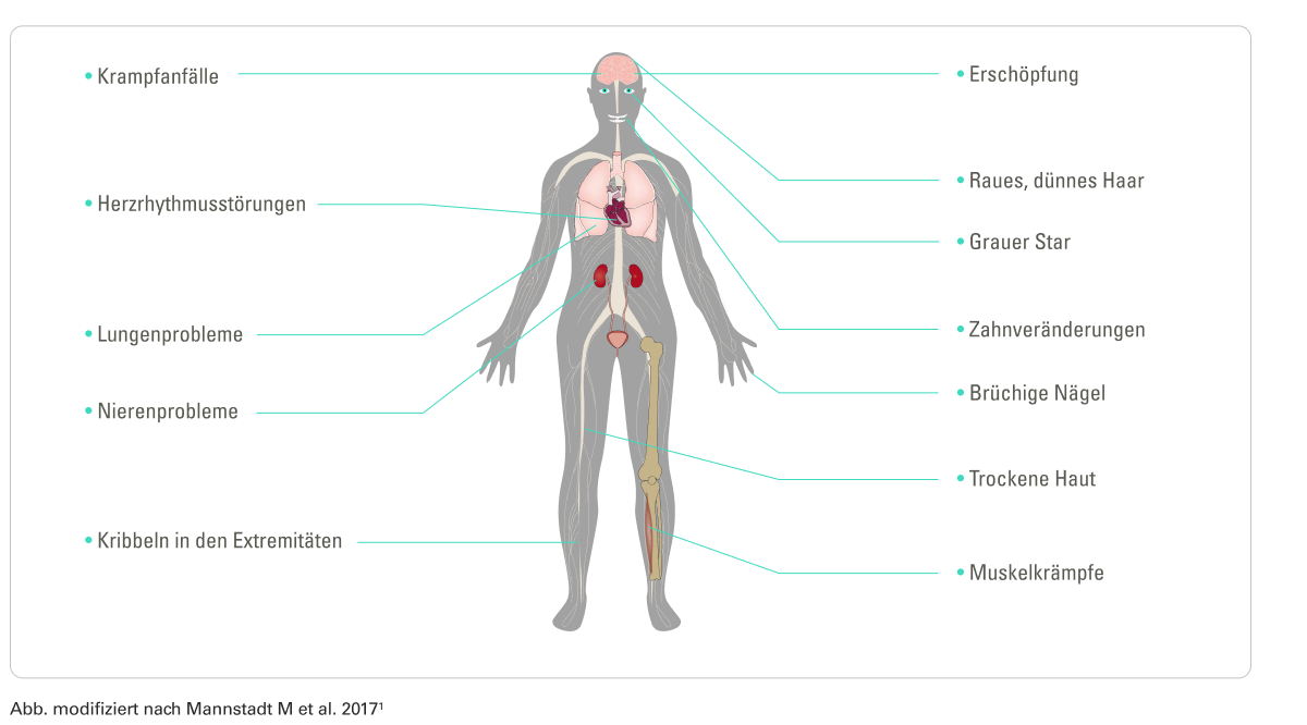 Typische Symptome einer Nebenschilddrüsenunterfunktion (Hypoparathyreoidismus).